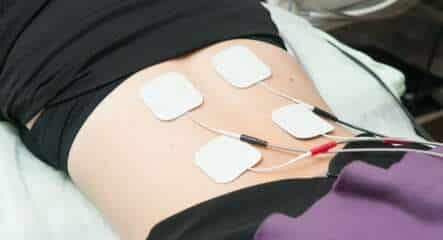 Electrostimulation dorsale